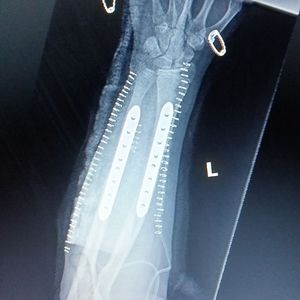 Meet your Posher, Greggory